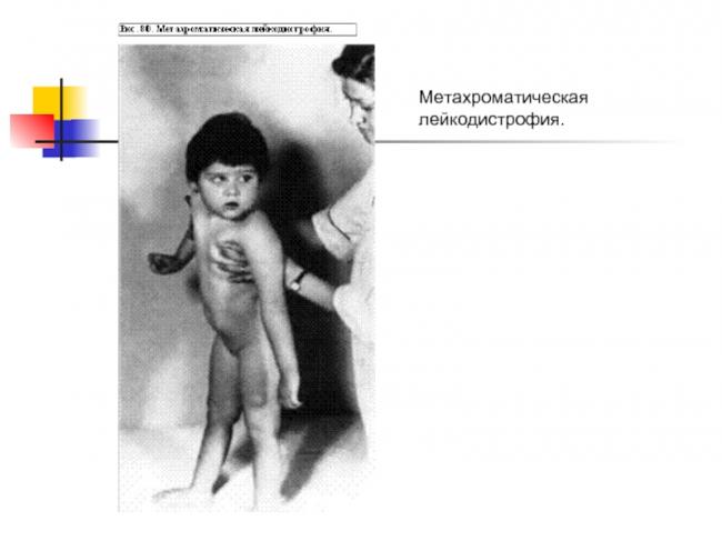 Лечение в италии