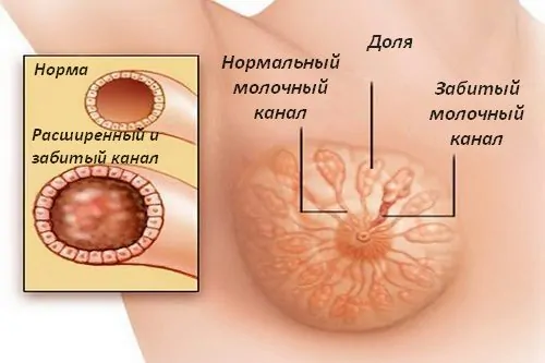 Грудное вскармливание в 21 веке: эпидемиология, механизмы и его эффект на дальнейшую жизнь
