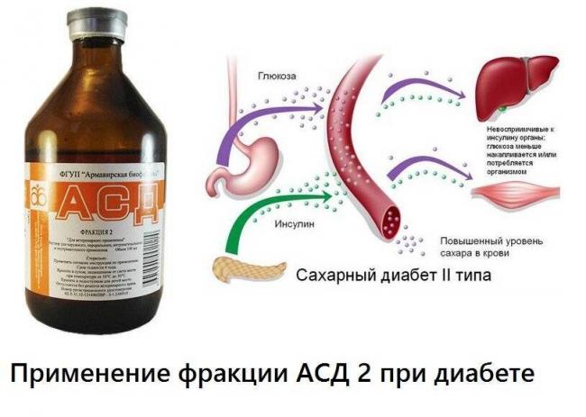 Фракция асд-2 при туберкулезе легких