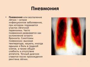 Температура 37.1 после левосторонней пневмонии