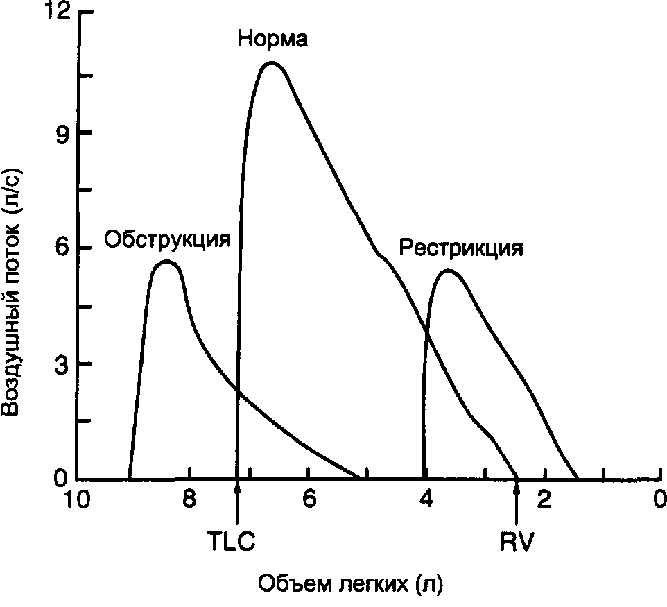 Спирография и спирометрия