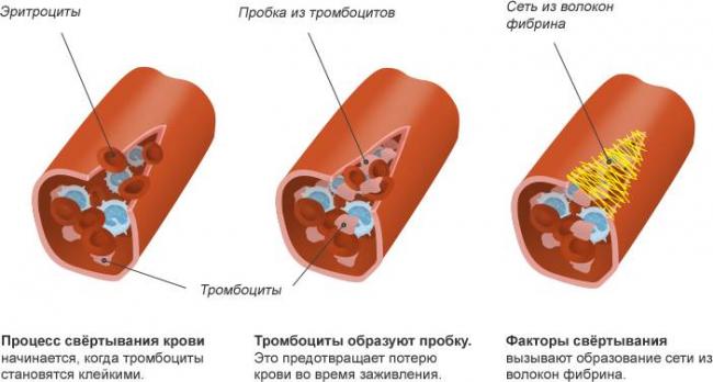 О чем говорит повышение или понижение тромбоцитов в крови