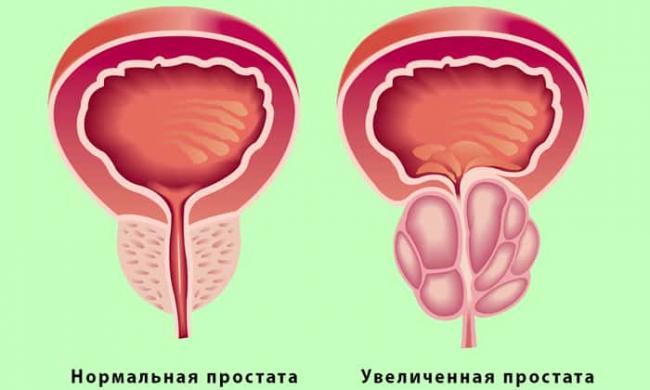 «афала» или «афалаза»: что лучше?