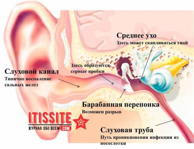 Лечение шума в ушах при остеохондрозе шейного отдела: может ли болеть и закладывать в левом ухе и как избавиться от звона?