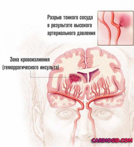 "андипал" - инструкция по применению, при каком давлении принимать, состав и отзывы