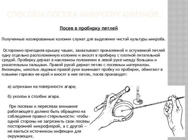 Особенности культивирования и выделения аэробных и анаэробных бактерий