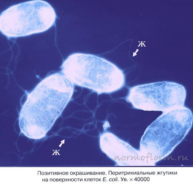 Бактерии «escherichia coli» в моче