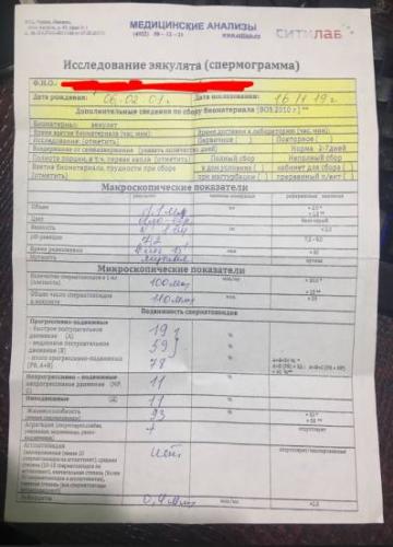 Варикоцеле