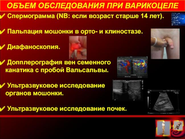 Варикоцеле – причины, симптомы, диагностика. лечение патологии: показания к операции, подготовка, виды операции, после операции. возможные осложнения после операции: боли, отек, швы. прогноз после варикоцеле.