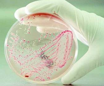 Escherichia coli (кишечная палочка)