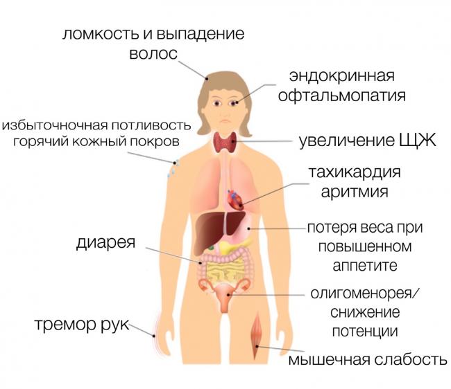 Почему увеличивается щитовидная железа