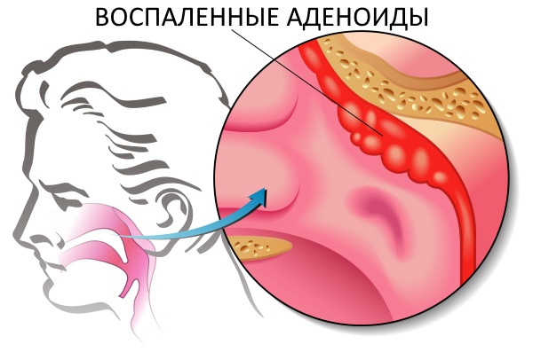 Умкалор - инструкция по применению