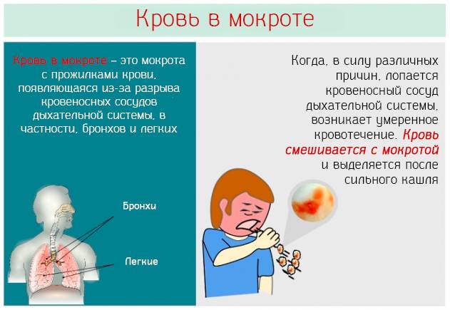 Откашливание мокроты с кровью – насколько это опасно?