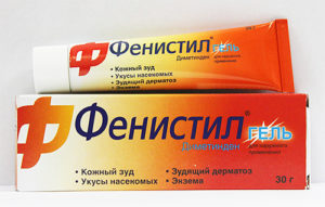 Укусы клопов на теле человека: когда проявляются, чем лечить и как избежать