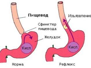 Урсосан инструкция по применению
