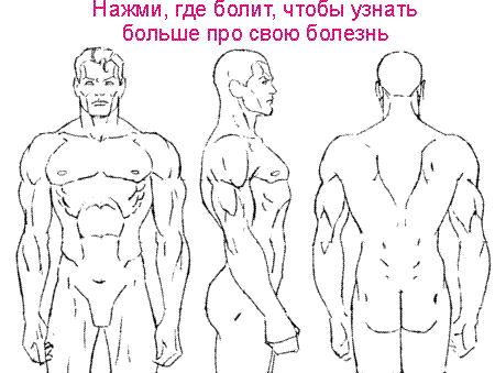 Ком в горле при остеохондрозе шейного отдела причины и что делать