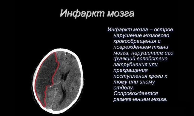 Тразикор