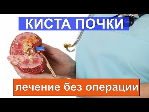 Киста на почке — что делать, чем вылечить?