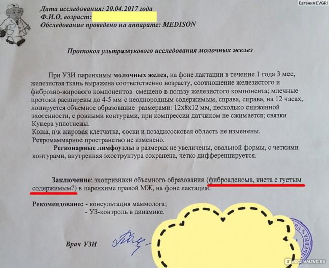 Как увеличить железистую ткань молочной железы