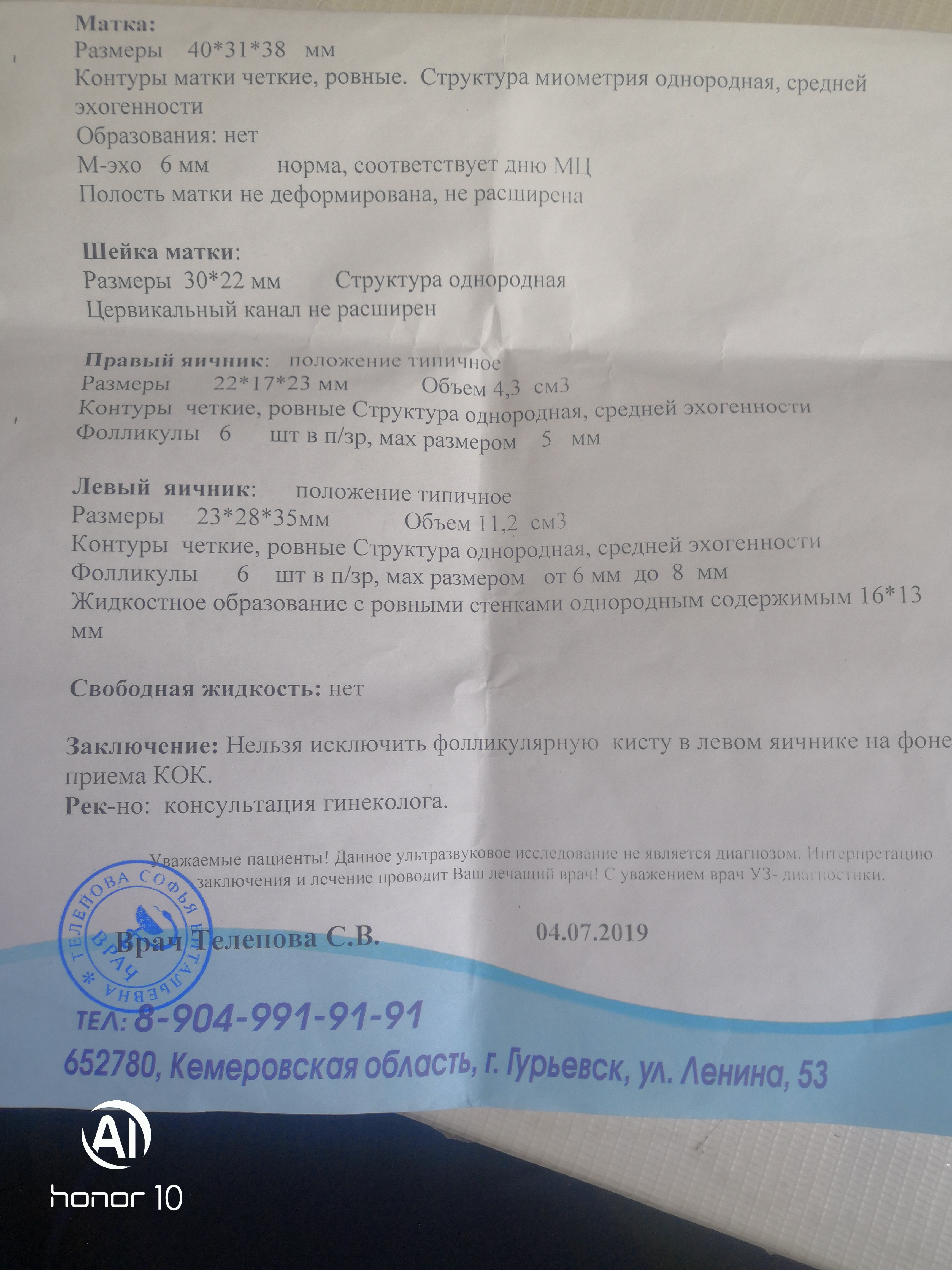 Лечение железистой гиперплазии эндометрия