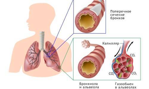 Виды и причины хронического бронхита, симптомы и методы лечения заболевания