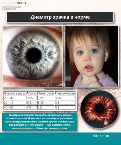 Причины миоза (суженных зрачков)