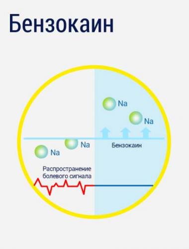 Геморрой – причины, о которых важно знать
