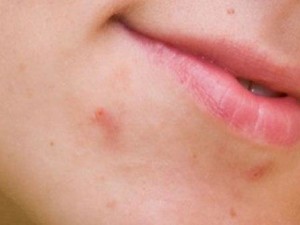Лактофильтрум - инструкция по применению, отзывы, аналоги и формы выпуска (таблетки) лекарственного препарата для лечения поноса и аллергии у взрослых, детей и при беременности. состав и действие