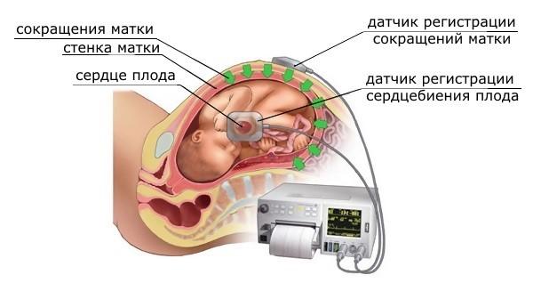 Симптомы и последствия гипоксии плода, диагностика и лечение