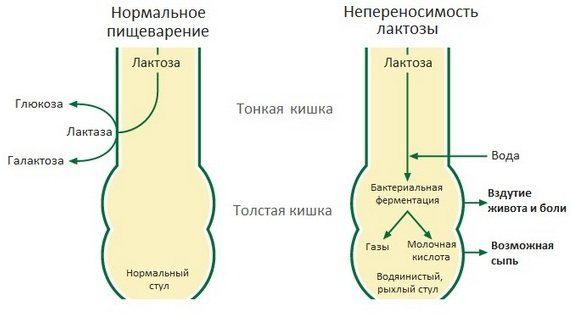 Донормил