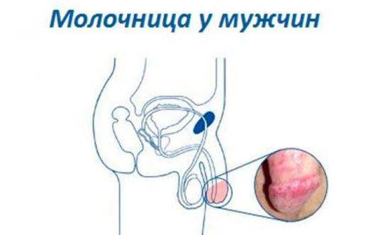 Пимафуцин мазь - состав, назначение, инструкция к применению