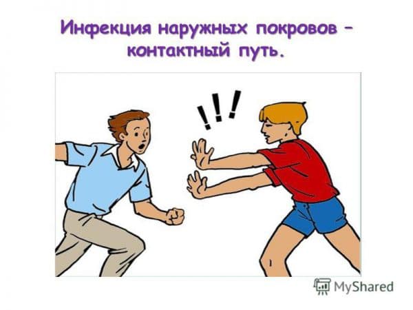 Туберкулез: пути передачи, симптомы, профилактика