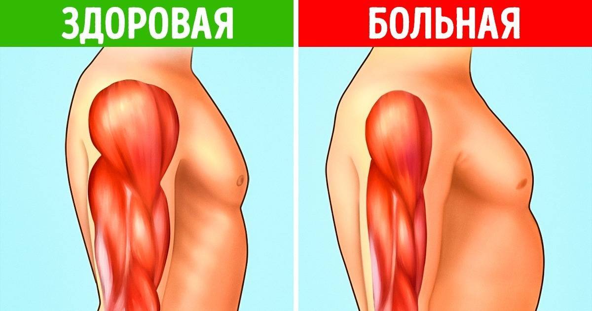 Осложнение на суставы у ребенка