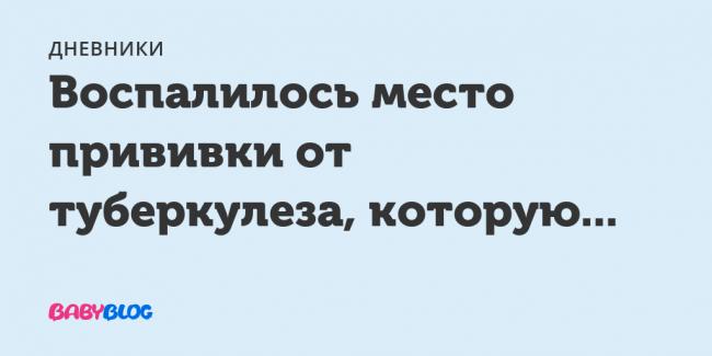 Можно ли лечить туберкулез легких амбулаторно и сколько дней держат в стационаре