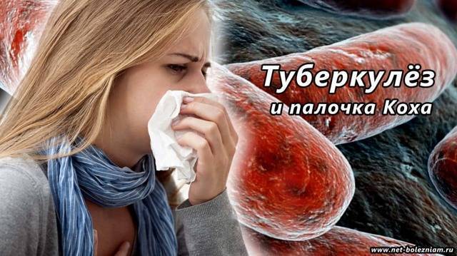 Классификация туберкулеза легких, его формы и стадии