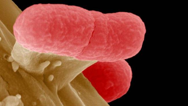 Escherichia coli в моче у грудничка или ребёнка, что это такое