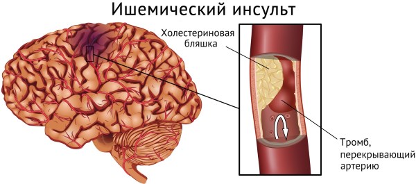 Инструкция по применению, для чего назначают рибоксин и эффективность в бодибилдинге
