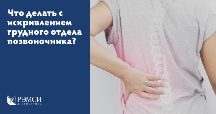 Искривление позвоночника у ребенка. виды, фото, степени, чем опасно, как исправить, лечить шейный, грудной, поясничный, боковое. массаж, упражнения, лфк