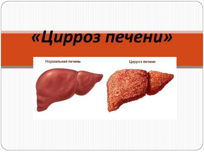 Эссенциале Н , Раствор для внутривенного введения