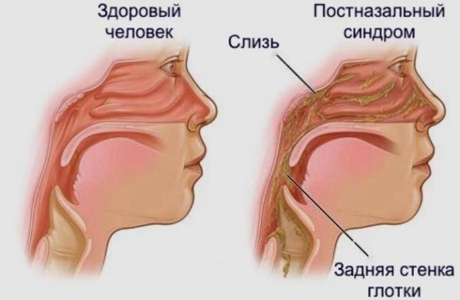 Почему кашель усиливается к вечеру