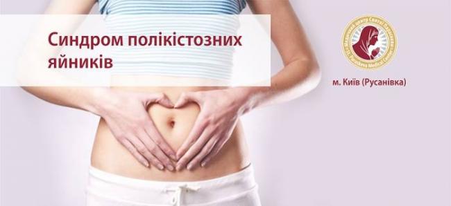 Основные методы лечения поликистоза яичников
