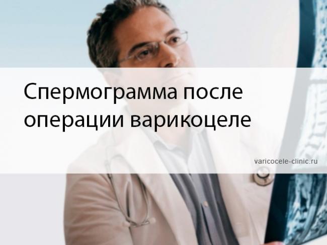 Варикоцеле