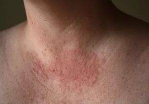 В чем разница между мирамистином и хлоргексидином кроме цены, и что лучше