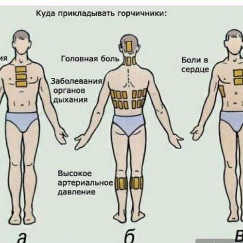 При воспалении легких ставят горчичники