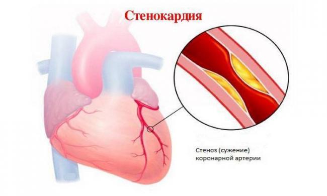 Кардил
(cardil)