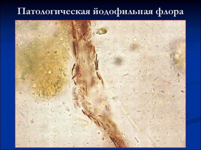 Чем грозит наличие йодофильной флоры в кале. йодофильная флора (капрограмма)