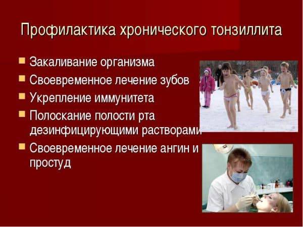 Хронический тонзиллит - на всю жизнь?
