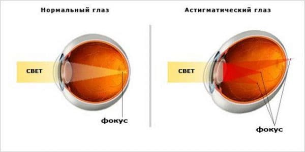 Подбор очков