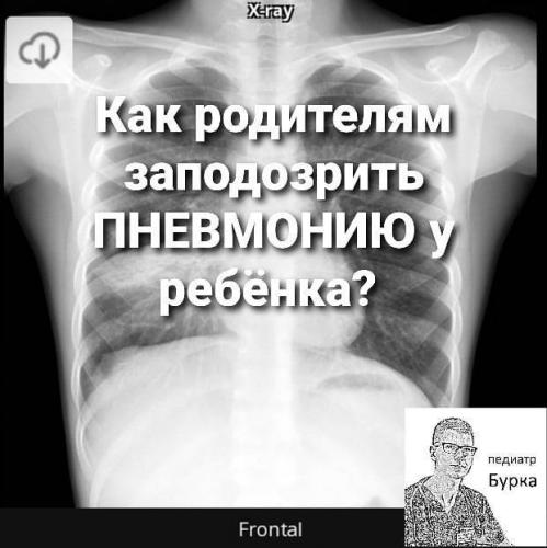 Причины возвращения температуры после лечения пневмонии