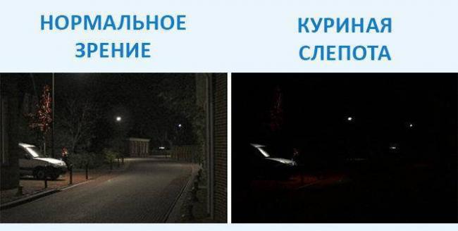 Что такое амавроз глаза: симптомы и лечение
